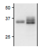 FNR1 | Ferredoxin NADP Reductase, isoprotein 1 (leaf) in the group Antibodies Plant/Algal / Photosynthesis / Electron transfer at Agrisera AB (Antibodies for research) (AS20 4439)